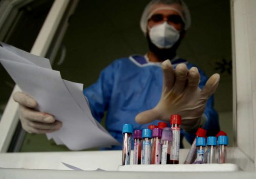 virus-korona-kovid-ilustracija-05-foto-s-pasalic-872x610